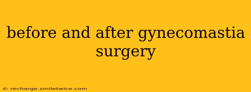 before and after gynecomastia surgery