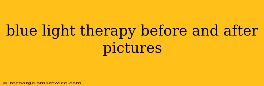 blue light therapy before and after pictures