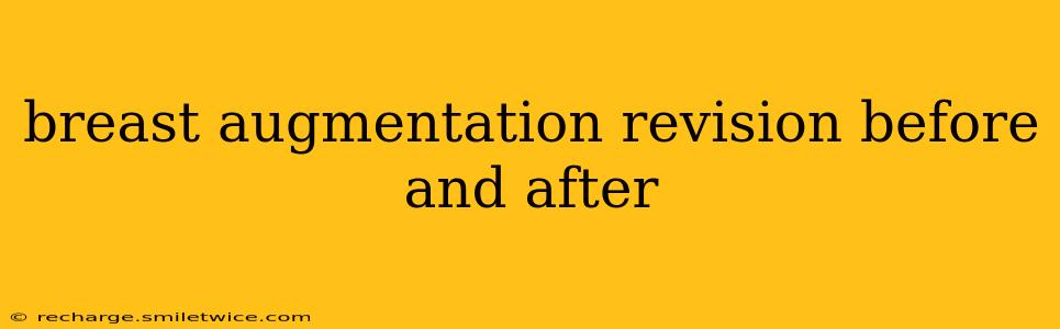 breast augmentation revision before and after