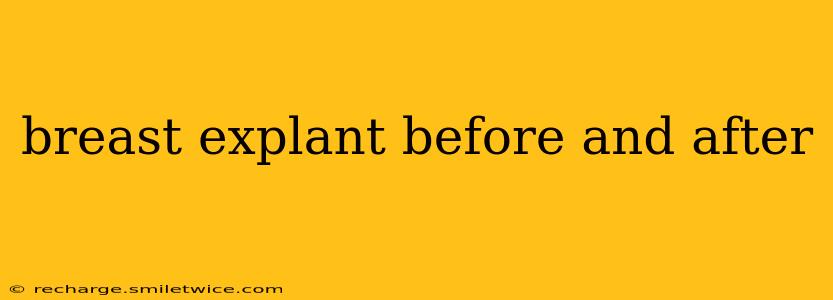 breast explant before and after