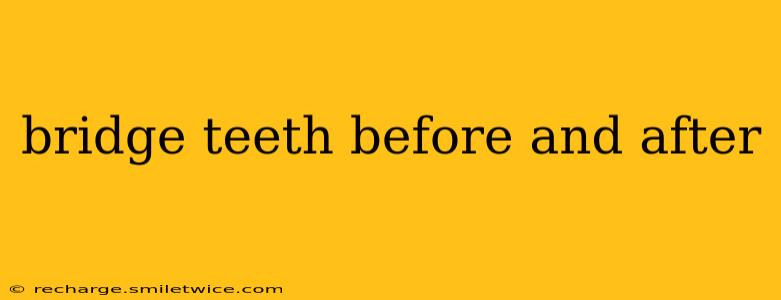 bridge teeth before and after
