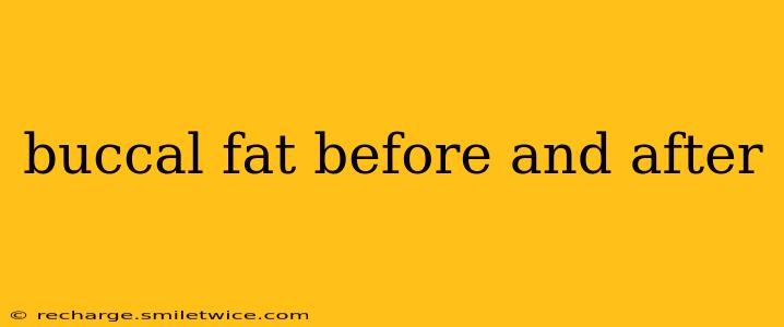 buccal fat before and after