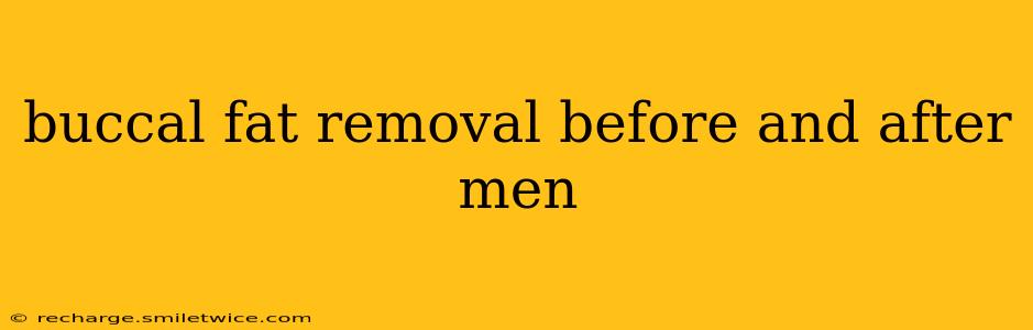 buccal fat removal before and after men