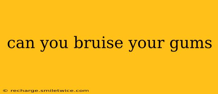 can you bruise your gums