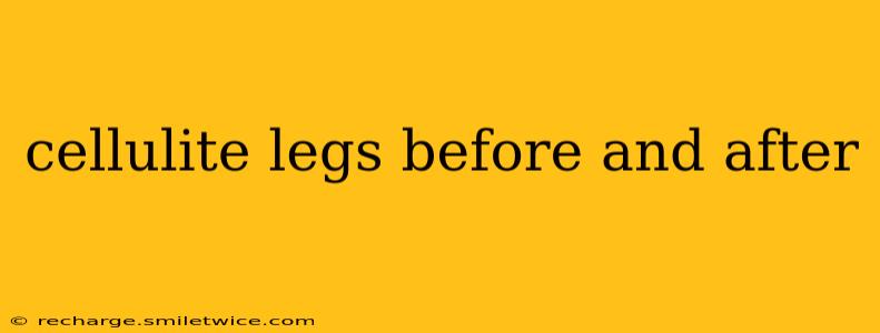 cellulite legs before and after