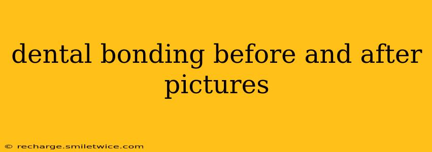 dental bonding before and after pictures