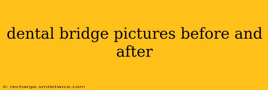 dental bridge pictures before and after