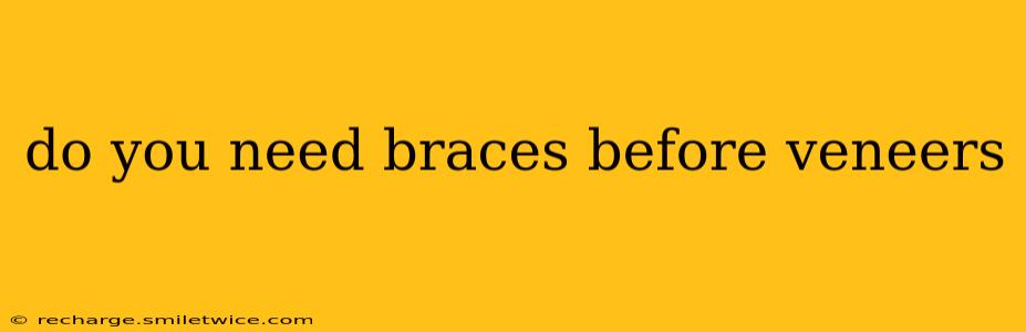 do you need braces before veneers