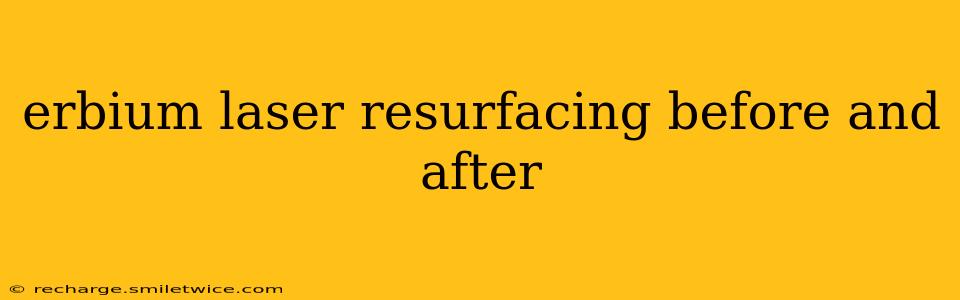 erbium laser resurfacing before and after