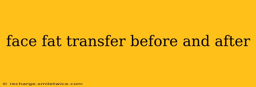 face fat transfer before and after