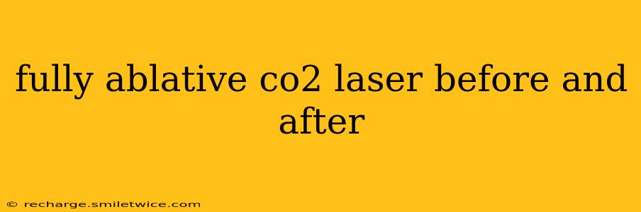 fully ablative co2 laser before and after