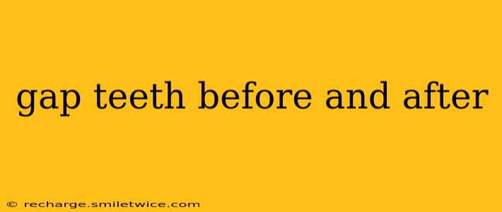 gap teeth before and after