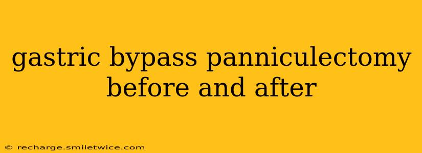 gastric bypass panniculectomy before and after