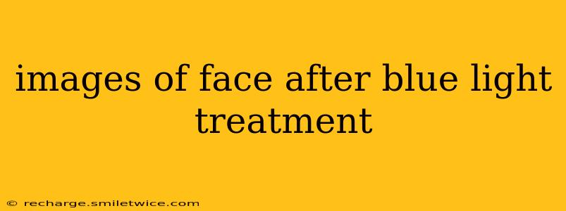 images of face after blue light treatment
