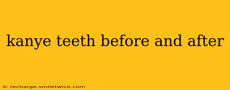 kanye teeth before and after