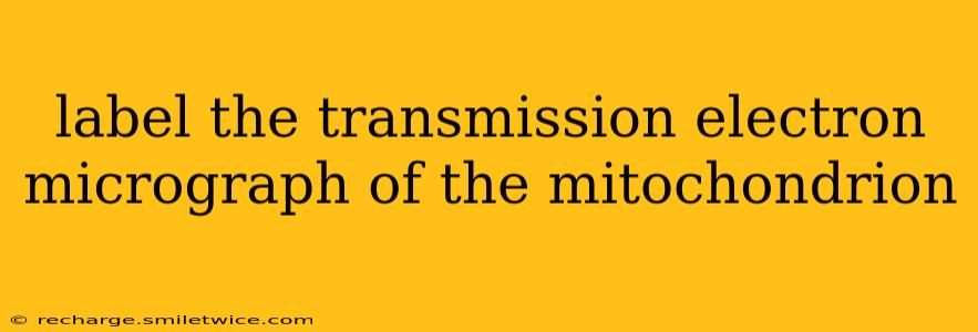 label the transmission electron micrograph of the mitochondrion