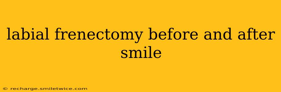 labial frenectomy before and after smile