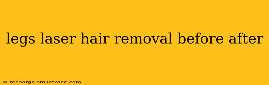 legs laser hair removal before after
