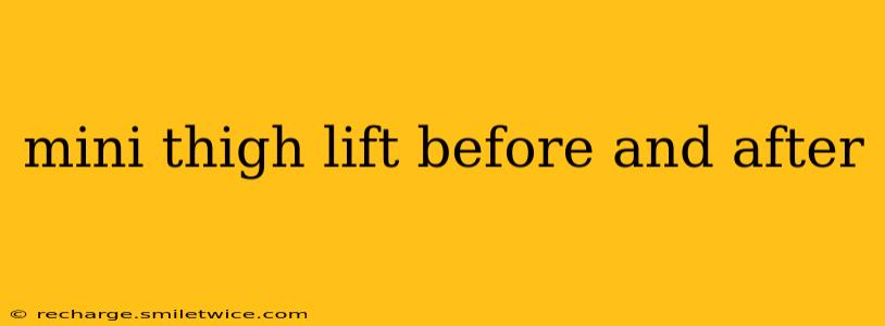 mini thigh lift before and after