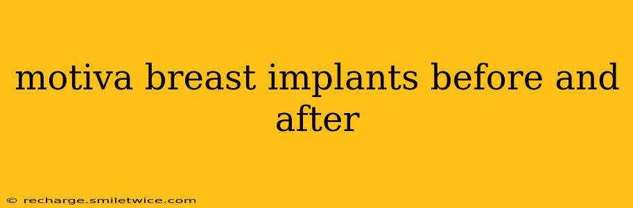 motiva breast implants before and after