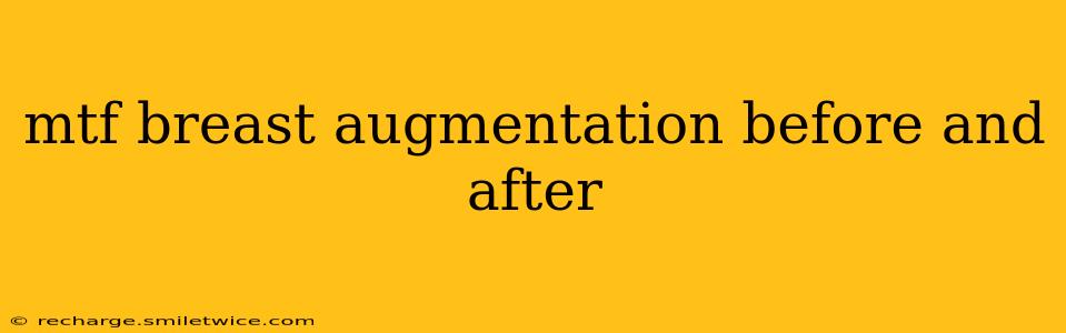mtf breast augmentation before and after