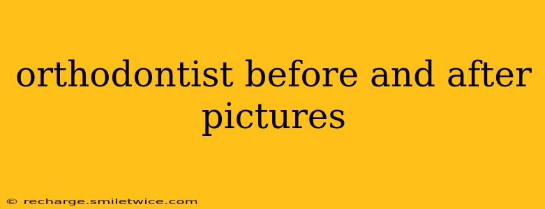 orthodontist before and after pictures