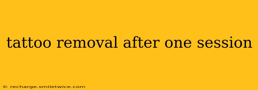 tattoo removal after one session