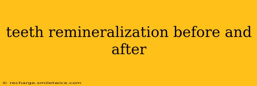 teeth remineralization before and after