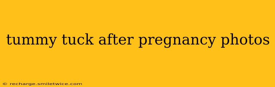 tummy tuck after pregnancy photos