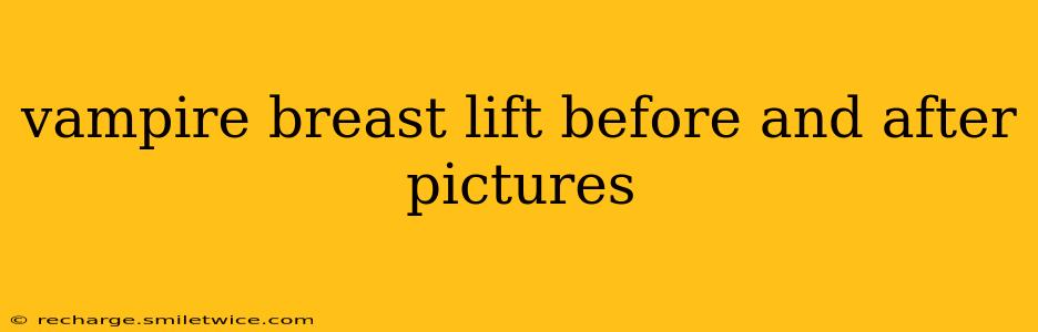 vampire breast lift before and after pictures