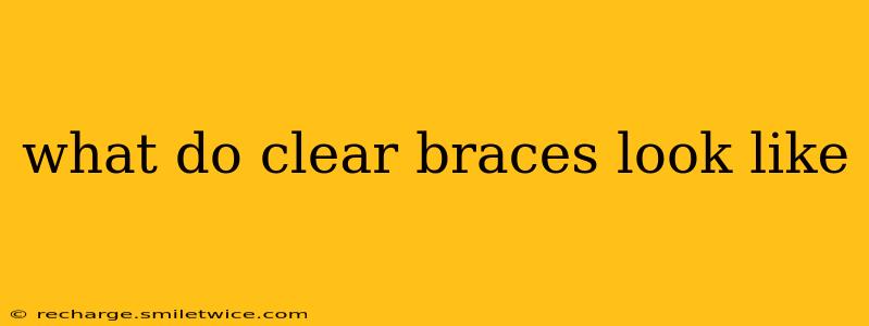 what do clear braces look like