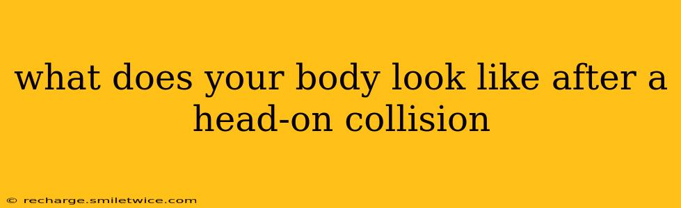 what does your body look like after a head-on collision