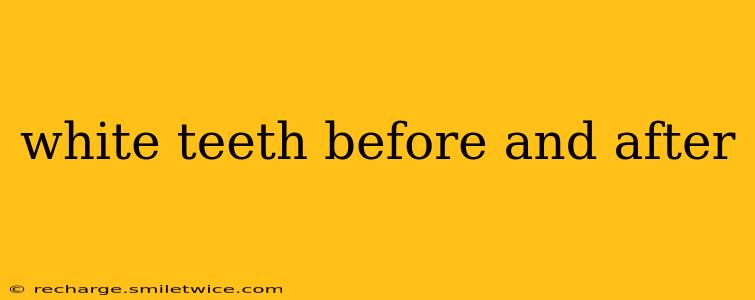 white teeth before and after