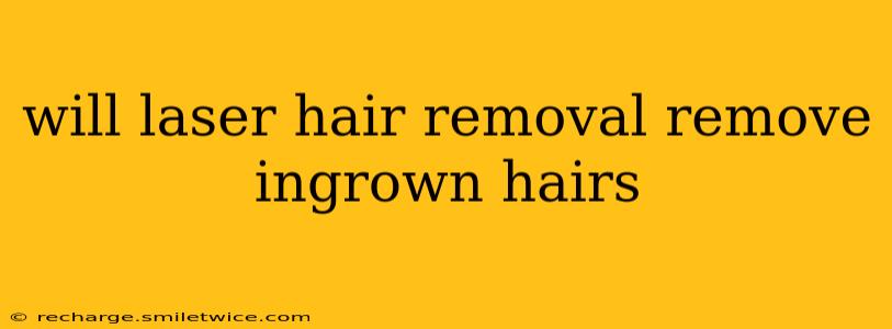 will laser hair removal remove ingrown hairs