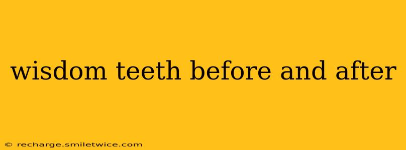 wisdom teeth before and after
